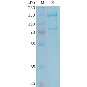 Human PVRIG(53-150) Protein, hFc Tag