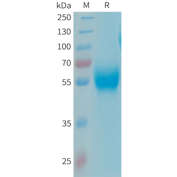 Human RNF133 Protein, hFc Tag
