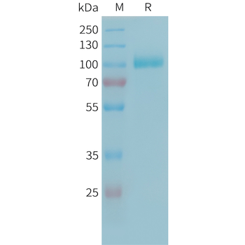 Human ACVR2A Protein, hFc Tag