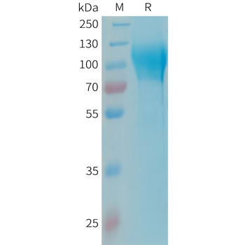 Human APOE2 Protein, His Tag