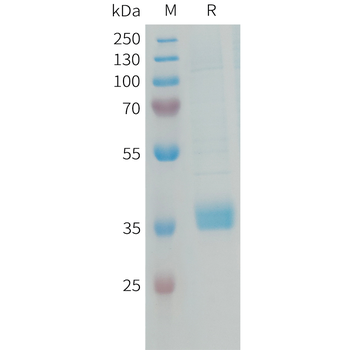 Human APOE4 Protein, His Tag