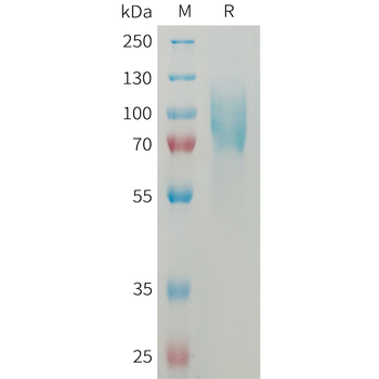 Human IFNGR1 Protein, His Tag