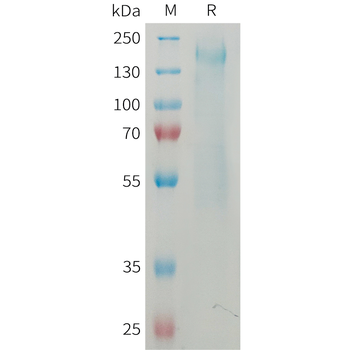 Human DPEP3 Protein, His Tag