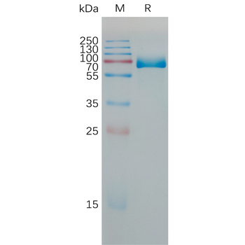 Human CD73 Protein, His Tag