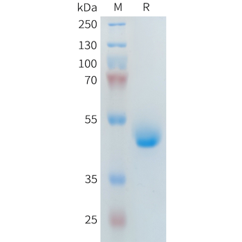 Human CD2 Protein, His Tag