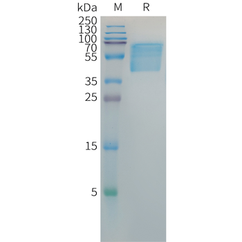 Human DLL3(428-492) Protein, hFc Tag
