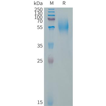 Human CEACAM5(589-685) Protein, hFc Tag