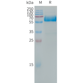 Human ADAM17 Protein, hFc Tag