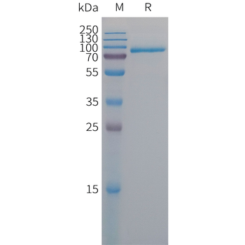 Human EFNA1 Protein, hFc Tag