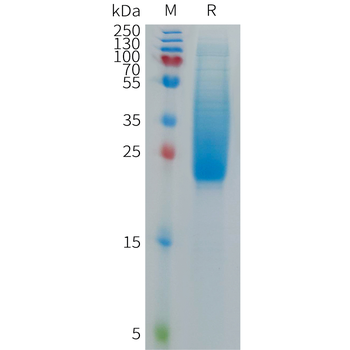 Human DLL4 Protein, His Tag