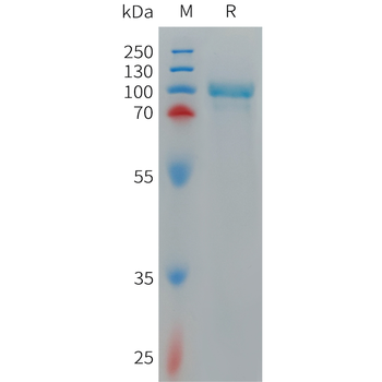 Human TPO Protein, His Tag