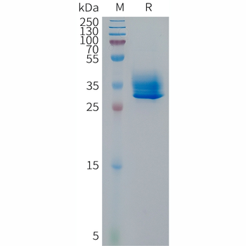 Human ITGAV and ITGB5 Heterodimer Protein, His Tag and hFc Tag