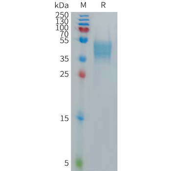 Human APOE Protein, His Tag