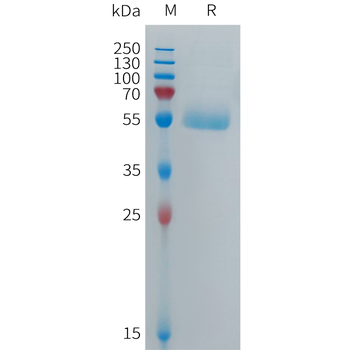 Human C9 Protein, His Tag