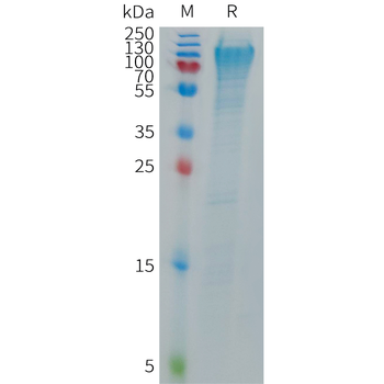 Human CD209 Protein, His Tag