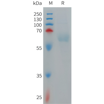 Human CMKLR1 Protein, hFc Tag