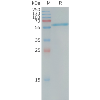 Human CD33(18-259) Protein, His Tag
