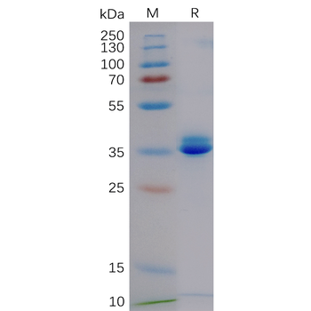 Human ADAMTS13 Protein, His Tag
