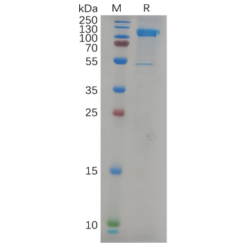 Human KI67(1206-1238) Protein, hFc Tag