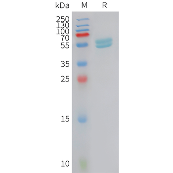 Human CD117(309-412) Protein, hFc Tag
