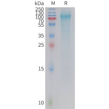 Human CDH3(329-440) Protein, hFc Tag