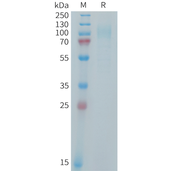 Human CDH17(23-128) Protein, hFc Tag