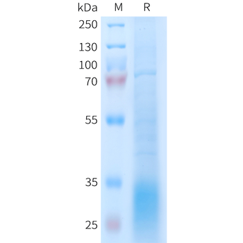 Human Nectin-4(238-349) Protein, hFc Tag