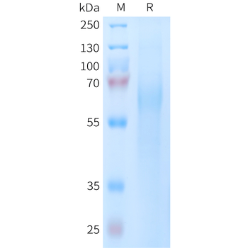 Human Nectin-4(145-247) Protein, hFc Tag