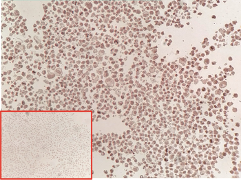 GPC3 Antibody