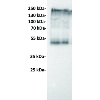 CEACAM5 Antibody