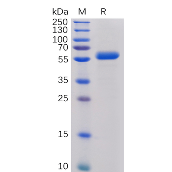 Human ICOS Protein, mFc-His tag