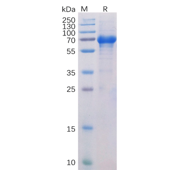 Human FLT3 Ligand Protein, mFc-His Tag