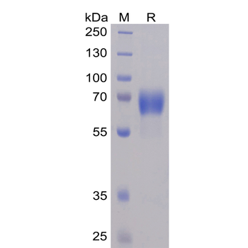 Human CLDN6 Protein, mFc Tag