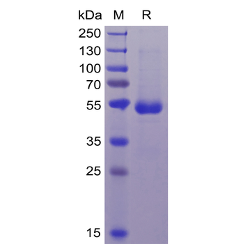 Human GPRC5D Protein, hFc-His Tag