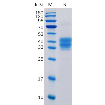 Human CSF1R Protein, His Tag