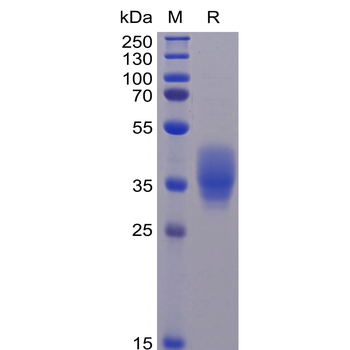 Human AXL Protein, His Tag