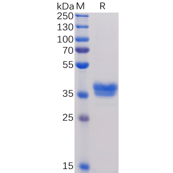 Human ACE2 Protein, mFc Tag