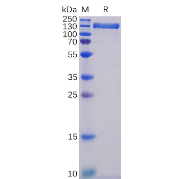 Human IL2RB Protein, His Tag
