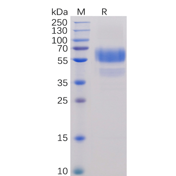 Human PSCA Protein, hFc Tag