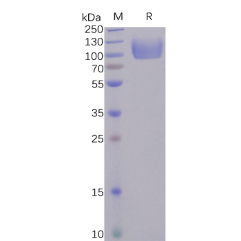 Human SELP Protein, hFc Tag