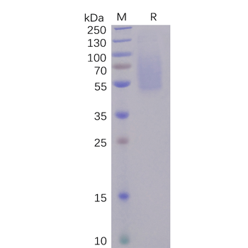 Human HER3 Protein, His Tag