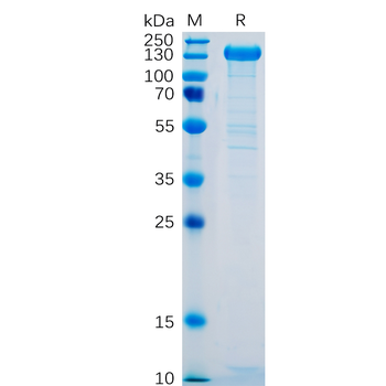 Human IL2RA Protein, His Tag