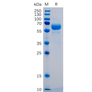 Human EGFR Protein, His Tag
