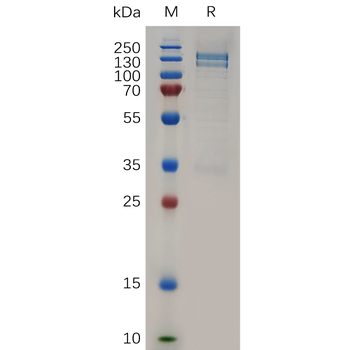 SARS-CoV-2 (2019-nCoV) Nucleocapsid, N-His Tag