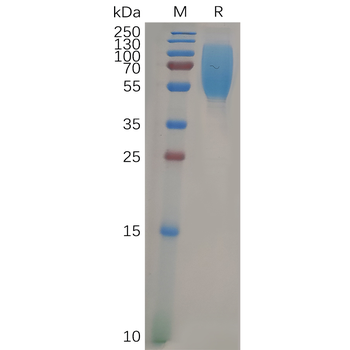 Human CD5 Protein, His Tag