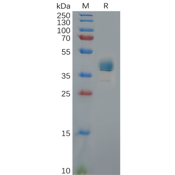 Human B7-1 Protein, hFc Tag