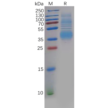 SARS-CoV-2 (2019-nCoV) S1 protein NTD, His Tag