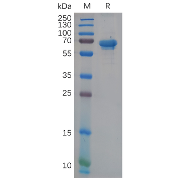 SARS-CoV-2 (2019-nCoV) S1 protein NTD, hFc Tag
