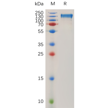 SARS-CoV-2 (2019-nCoV) Nucleocapsid, C-His Tag