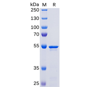 Human B7-1 Protein, mFc-His Tag